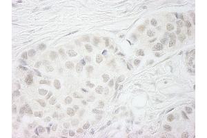 Immunohistochemistry (IHC) image for anti-Budding Uninhibited By Benzimidazoles 1 Homolog beta (Yeast) (BUB1B) (AA 1-50) antibody (ABIN7448450) (BUB1B antibody  (AA 1-50))