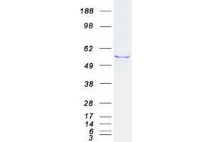 Western Blotting (WB) image for Interferon-Induced Protein with Tetratricopeptide Repeats 1 (IFIT1) (Transcript Variant 2) protein (Myc-DYKDDDDK Tag) (ABIN2723302)