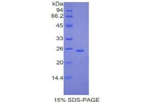 SDS-PAGE (SDS) image for Desmocollin 1 (DSC1) (AA 135-340) protein (His tag) (ABIN1877353) (Desmocollin 1 Protein (DSC1) (AA 135-340) (His tag))