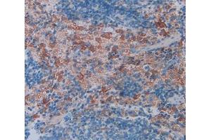 IHC-P analysis of Rat Spleen Tissue, with DAB staining. (FCN1 antibody  (AA 25-279))