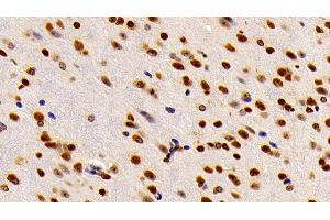 Immunohistochemistry (IHC) image for anti-High Mobility Group Box 1 (HMGB1) (AA 1-215) antibody (ABIN7431743)