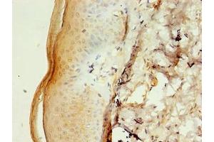 Immunohistochemistry of paraffin-embedded human skin tissue using ABIN7146503 at dilution of 1:100 (CALML5 antibody  (AA 2-146))
