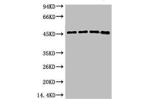 Western blot analysis of 1) Hela, 2) 293T, 3) Mouse Brain Tissue, 4) Rat Brain Tissue using GAP-43 Monoclonal Antibody. (GAP43 antibody)