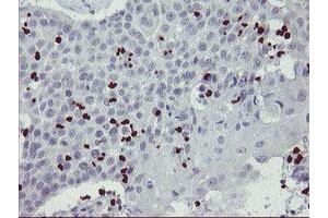 Image no. 4 for anti-Peptidyl Arginine Deiminase, Type IV (PADI4) (AA 299-588) antibody (ABIN1491357) (PAD4 antibody  (AA 299-588))