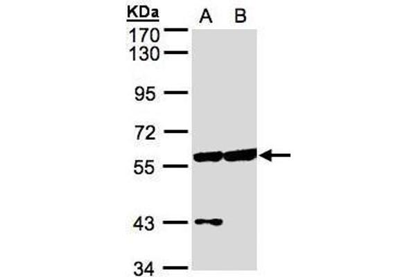 Copine III antibody
