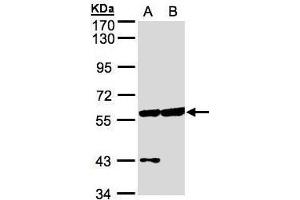 WB Image Sample(30 μg of whole cell lysate) A:HeLa S3, B:Hep G2, 7. (Copine III antibody)