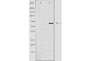 Western blot analysis of extracts from 293 cells, using TIGD1 antibody.