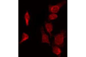 ABIN6272357 staining HepG2 by IF/ICC. (NEK9 antibody  (Internal Region))