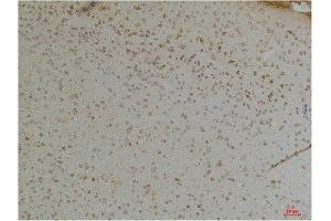 Immunohistochemistry (IHC) analysis of paraffin-embedded Mouse Brain Tissue using KChIP1 Rabbit Polyclonal Antibody diluted at 1:200.