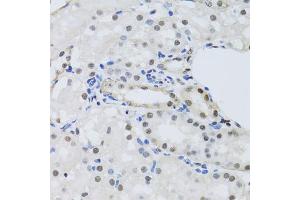 Immunohistochemistry of paraffin-embedded mouse kidney using PRPF19 antibody.