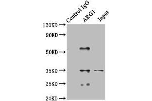 Immunoprecipitating SOD1 in HEK293 whole cell lysate Lane 1: Rabbit control IgG (1 μg) instead of ABIN7144580 in HEK293 whole cell lysate. (Liver Arginase antibody  (AA 1-322))