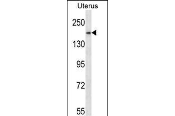 SMC1B antibody  (AA 737-765)