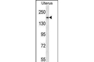 SMC1B Antibody (Center) (ABIN657773 and ABIN2846748) western blot analysis in human normal Uterus tissue lysates (35 μg/lane). (SMC1B antibody  (AA 737-765))