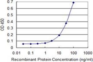 Detection limit for recombinant GST tagged ZKSCAN5 is 1 ng/ml as a capture antibody. (ZKSCAN5 antibody  (AA 1-839))