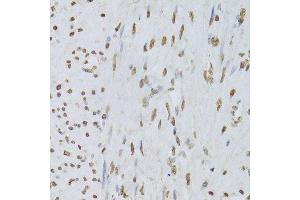 Immunohistochemistry (Paraffin-embedded Sections) (IHC (p)) image for anti-Heterogeneous Nuclear Ribonucleoprotein D (HNRNPD) (AA 1-306) antibody (ABIN6141905)