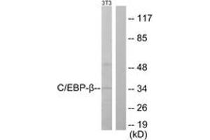 Western blot analysis of extracts from NIH-3T3 cells, using C/EBP-beta (Ab-235/188) Antibody. (CEBPB antibody  (AA 201-250))