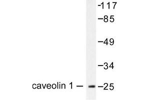 Image no. 1 for anti-Caveolin 1, Caveolae Protein, 22kDa (CAV1) antibody (ABIN265338) (Caveolin-1 antibody)
