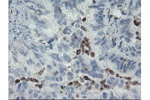 Image no. 2 for anti-Myosin Light Chain 7, Regulatory (MYL7) antibody (ABIN1499491) (MYL7 antibody)