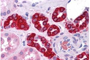 Human Kidney: Formalin-Fixed, Paraffin-Embedded (FFPE) (AGR3 antibody)