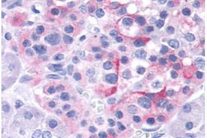 Anti-TRPV4 antibody  ABIN1049441 IHC staining of human pancreas, islet. (TRPV4 antibody  (Internal Region))