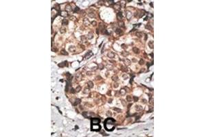 Immunohistochemistry (Paraffin-embedded Sections) (IHC (p)) image for anti-HtrA Serine Peptidase 3 (HTRA3) (AA 112-144), (N-Term) antibody (ABIN1882095)
