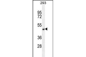 COCH Antibody (C-term) (ABIN655279 and ABIN2844871) western blot analysis in 293 cell line lysates (35 μg/lane). (COCH antibody  (C-Term))