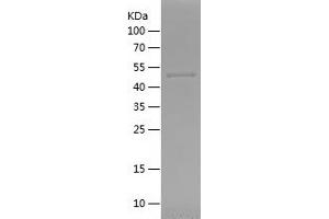 Western Blotting (WB) image for Ribosomal Protein S6 Kinase, 90kDa, Polypeptide 2 (RPS6KA2) (AA 66-311) protein (His-IF2DI Tag) (ABIN7124904) (RPS6KA2 Protein (AA 66-311) (His-IF2DI Tag))