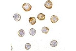 Immunohistochemistry (IHC) image for anti-Disrupted in Schizophrenia 1 (DISC1) (Middle Region) antibody (ABIN1030920) (DISC1 antibody  (Middle Region))