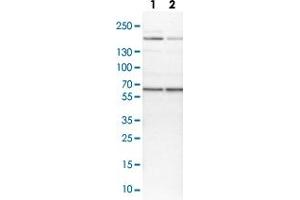 Western blot analysis of Lane 1: NIH-3T3 cell lysate (Mouse embryonic fibroblast cells) Lane 2: NBT-II cell lysate (Rat Wistar bladder tumour cells) with USP14 polyclonal antibody  at 1:100-1:250 dilution. (USP14 antibody)