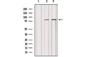 Western blot analysis of extracts from various samples, using ACSL4/FACL4 Antibody.