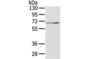 Western Blotting (WB) image for anti-Transducin (Beta)-Like 1X-Linked (TBL1X) antibody (ABIN5961943)