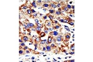 Image no. 1 for anti-Histone Deacetylase 8 (HDAC8) (N-Term) antibody (ABIN356653) (HDAC8 antibody  (N-Term))