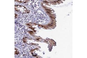 Immunohistochemical staining of human rectum with MUC13 polyclonal antibody  shows strong cytoplasmic positivity in goblet cells. (MUC13 antibody)