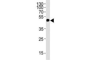 Western blot analysis of lysate from 12-Tag protein using c-Myc antibody; Ab was diluted at 1:4000. (Myc Tag antibody  (AA 408-439))