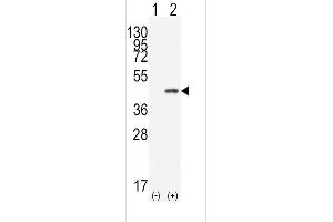 Western blot analysis of CDX2(arrow) using rabbit polyclonal CDX2 Antibody (N-term) (ABIN390076 and ABIN2840597).