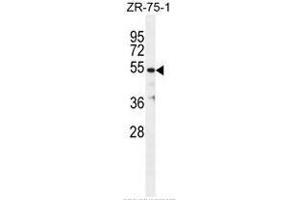 TBB1 Antibody (N-term) western blot analysis in ZR-75-1 cell line lysates (35µg/lane). (TUBB1 antibody  (N-Term))