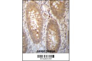 DHRS7B Antibody immunohistochemistry analysis in formalin fixed and paraffin embedded human colon tissue followed by peroxidase conjugation of the secondary antibody and DAB staining. (DHRS7B antibody  (AA 133-161))