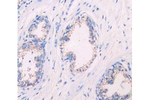 IHC-P analysis of prostate gland tissue, with DAB staining. (SIGIRR antibody  (AA 1-118))