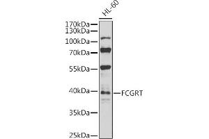Western blot analysis of extracts of HL-60 cells, using FCGRT antibody (ABIN6127922, ABIN6140552, ABIN6140553 and ABIN6224639) at 1:1000 dilution. (FcRn antibody  (AA 25-300))