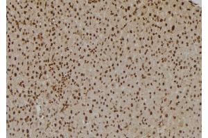 ABIN6257992 and ABIN6275831 at 1/100 staining Rat liver tissue by IHC-P. (TRAF2 antibody  (C-Term))