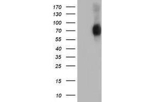 Western Blotting (WB) image for anti-SH2B Adaptor Protein 3 (SH2B3) antibody (ABIN1500910) (SH2B3 antibody)