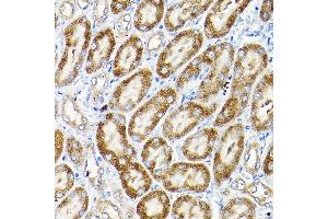 Immunohistochemistry of paraffin-embedded mouse kidney using SCFD1 Rabbit pAb (ABIN6132633, ABIN6147418, ABIN6147419 and ABIN6224809) at dilution of 1:200 (40x lens). (SCFD1 antibody  (AA 373-642))