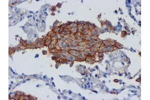 Immunohistochemistry (IHC) image for anti-CD80 (CD80) antibody (ABIN1497372) (CD80 antibody)