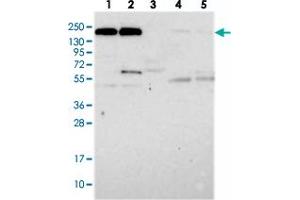 Western blot analysis of Lane 1: RT-4, Lane 2: U-251 MG, Lane 3: Human Plasma, Lane 4: Liver, Lane 5: Tonsil with DOCK3 polyclonal antibody  at 1:250-1:500 dilution.