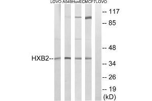 Western blot analysis of extracts from LOVO cells, A549 cells, HUVEC cells and MCF-7 cells, using HOXB2 antibody. (HOXB2 antibody  (Internal Region))