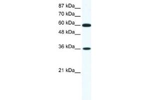 WB Suggested Anti-FOXF1 Antibody Titration: 1. (FOXF1 antibody  (N-Term))