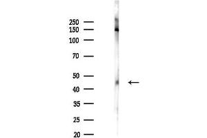 anti-STAT5 A/B (STAT5 A/B) (pSer725), (pSer730) antibody