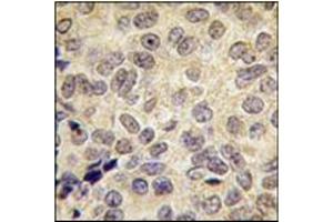 Image no. 3 for anti-DNA (Cytosine-5-)-Methyltransferase 3 beta (DNMT3B) (Middle Region) antibody (ABIN356569) (DNMT3B antibody  (Middle Region))