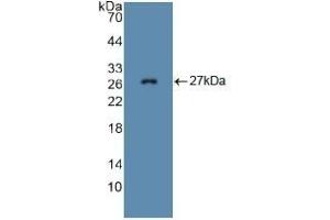Detection of Recombinant FBN1, Mouse using Polyclonal Antibody to Fibrillin 1 (FBN1) (Fibrillin 1 antibody  (AA 959-1145))