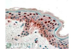 ABIN185539 (2. (14-3-3 sigma/SFN antibody  (Internal Region))